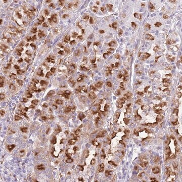 Anti-SNX6 antibody produced in rabbit Prestige Antibodies&#174; Powered by Atlas Antibodies, affinity isolated antibody, buffered aqueous glycerol solution