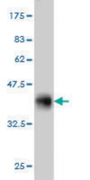 ANTI-GRK6 antibody produced in mouse clone 8D4, purified immunoglobulin, buffered aqueous solution