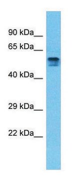 Anti-PDE4D (C-terminal) antibody produced in rabbit affinity isolated antibody