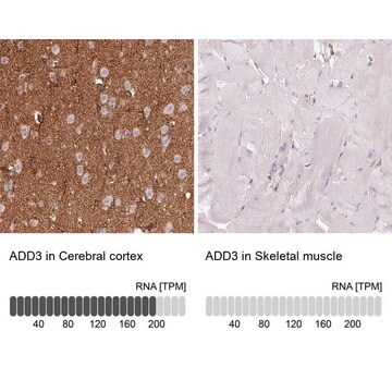 Anti-ADD3 antibody produced in rabbit Prestige Antibodies&#174; Powered by Atlas Antibodies, affinity isolated antibody, buffered aqueous glycerol solution