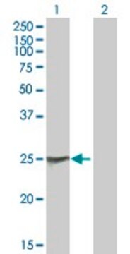 Anti-NAB2 antibody produced in mouse purified immunoglobulin, buffered aqueous solution