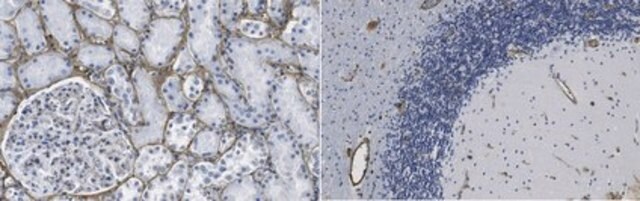 Anti-Fibronectin Antibody, cell binding domain Antibody, clone P1H11 clone P1H11, from mouse