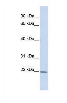 Anti-ZFAND5 antibody produced in rabbit affinity isolated antibody