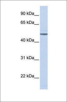 Anti-ADRB1 antibody produced in rabbit affinity isolated antibody