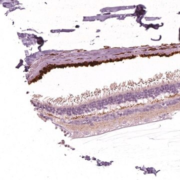 Anti-ARMS2 antibody produced in rabbit Prestige Antibodies&#174; Powered by Atlas Antibodies, affinity isolated antibody