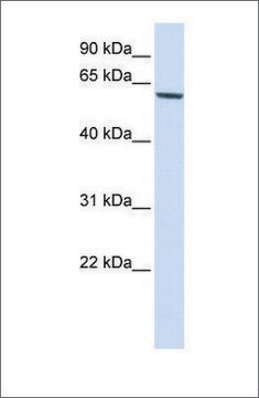 Anti-FOXO4 antibody produced in rabbit affinity isolated antibody