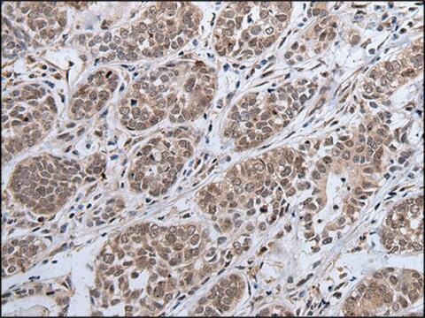 Anti-IWS1 affinity isolated antibody