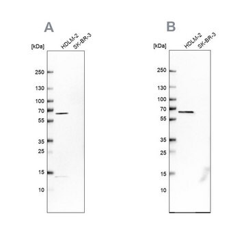 Anti-NMT1 antibody produced in rabbit Prestige Antibodies&#174; Powered by Atlas Antibodies, affinity isolated antibody, buffered aqueous glycerol solution, Ab1