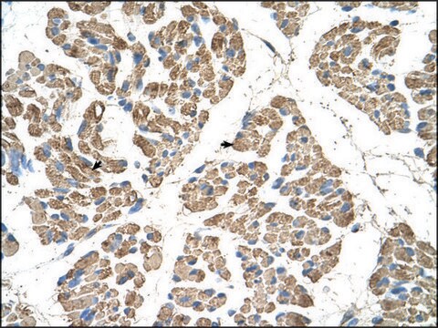 Anti-SLC22A7 (AB2) antibody produced in rabbit IgG fraction of antiserum