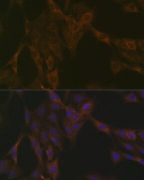 Anti-DDX6 Antibody, clone 6F9I6, Rabbit Monoclonal