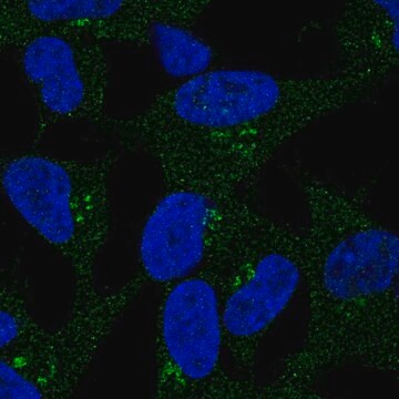 Anti-DKK2 antibody produced in rabbit Prestige Antibodies&#174; Powered by Atlas Antibodies, affinity isolated antibody