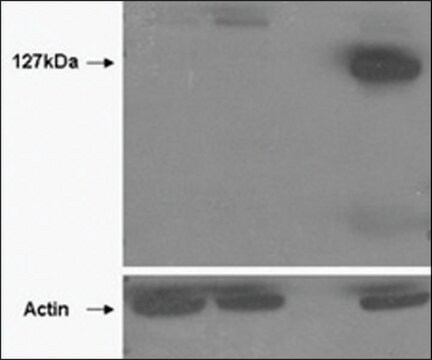 Anti-TNKS2 antibody produced in goat affinity isolated antibody, buffered aqueous solution