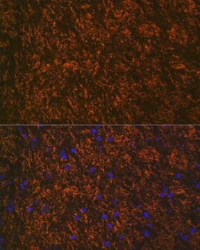 Anti-Myelin oligodendrocyte glycoprotein antibody produced in rabbit