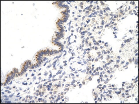 Anti-VDAC3 affinity isolated antibody