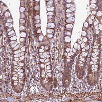 Anti-HGH1 antibody produced in rabbit Prestige Antibodies&#174; Powered by Atlas Antibodies, affinity isolated antibody, buffered aqueous glycerol solution