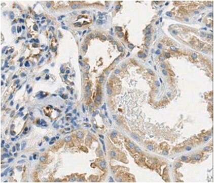 Anti-Mcpip1, clone 2H8.2 Antibody clone 2H8.2, from mouse