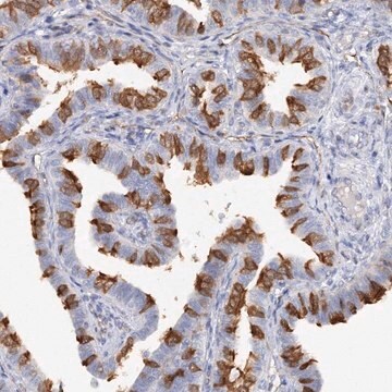 Anti-TAMM41 antibody produced in rabbit Prestige Antibodies&#174; Powered by Atlas Antibodies, affinity isolated antibody, buffered aqueous glycerol solution