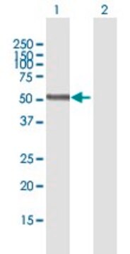 Anti-PNPLA3 antibody produced in mouse purified immunoglobulin, buffered aqueous solution