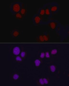 Anti-Brachyury Antibody, clone 2F8Y9, Rabbit Monoclonal