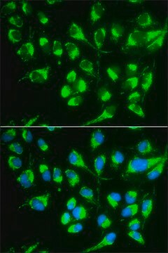 Anti-SLC22A5 antibody produced in rabbit affinity isolated antibody