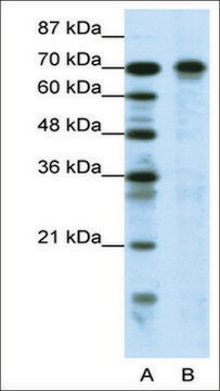 Anti-HIC1 antibody produced in rabbit affinity isolated antibody