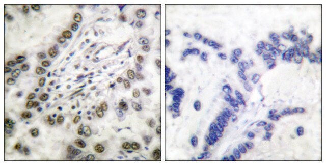 抗CBP抗体 ウサギ宿主抗体 affinity isolated antibody