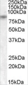 Anti-TRPV5 antibody produced in goat affinity isolated antibody, buffered aqueous solution