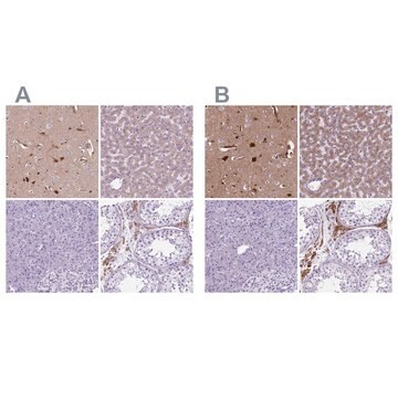 Anti-APOE antibody produced in rabbit Prestige Antibodies&#174; Powered by Atlas Antibodies, affinity isolated antibody, buffered aqueous glycerol solution