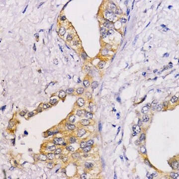 Anti-BCL2 antibody produced in rabbit