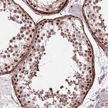 Anti-PSME4 antibody produced in rabbit Prestige Antibodies&#174; Powered by Atlas Antibodies, affinity isolated antibody, buffered aqueous glycerol solution