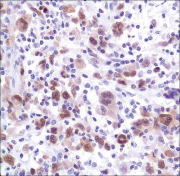 Anti-MUM1/IRF4 antibody, Rabbit monoclonal clone SP114, recombinant, expressed in proprietary host, affinity isolated antibody