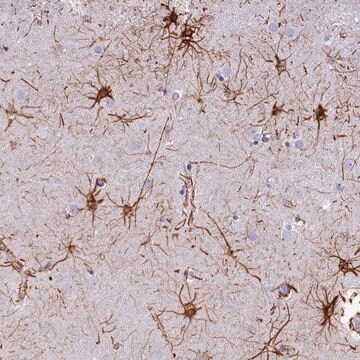 Anti-C17orf67 antibody produced in rabbit Prestige Antibodies&#174; Powered by Atlas Antibodies, affinity isolated antibody, buffered aqueous glycerol solution