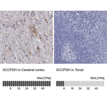 Anti-SCCPDH antibody produced in rabbit Prestige Antibodies&#174; Powered by Atlas Antibodies, affinity isolated antibody, buffered aqueous glycerol solution