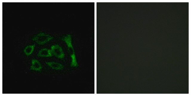 Anti-ERD22 antibody produced in rabbit affinity isolated antibody