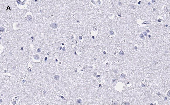 Anti-MBP Antibody, clone 2N6 , ZooMAb&#174; Rabbit Monoclonal recombinant, expressed in HEK 293 cells