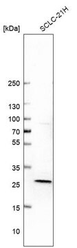 Anti-DGUOK antibody produced in rabbit Prestige Antibodies&#174; Powered by Atlas Antibodies, affinity isolated antibody, buffered aqueous glycerol solution