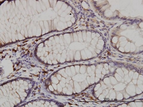 Monoclonal Anti-CDK5RAP3 antibody produced in mouse clone 1G4, purified immunoglobulin, buffered aqueous solution