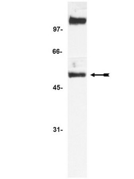 Anti-NF&#954;B p52 Antibody Upstate&#174;, from rabbit