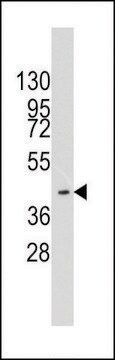 ANTI-HMOF/MYST1(C-TERMINAL) antibody produced in rabbit purified immunoglobulin, buffered aqueous solution