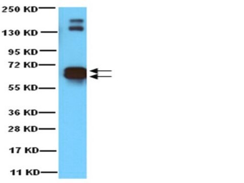 Anti-Glutamate Decarboxylase 65 &amp; 67 Antibody Chemicon&#174;, from rabbit