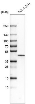 Anti-CSNK1E antibody produced in rabbit affinity isolated antibody, buffered aqueous glycerol solution