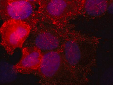 Anti-SORBS2 antibody,Mouse monoclonal clone S5C, purified from hybridoma cell culture