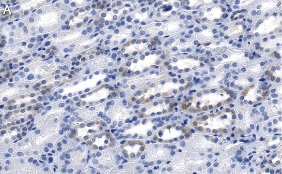 Anti-LPCAT1 Antibody, clone 1H15 ZooMAb&#174; Rabbit Monoclonal recombinant, expressed in HEK 293 cells