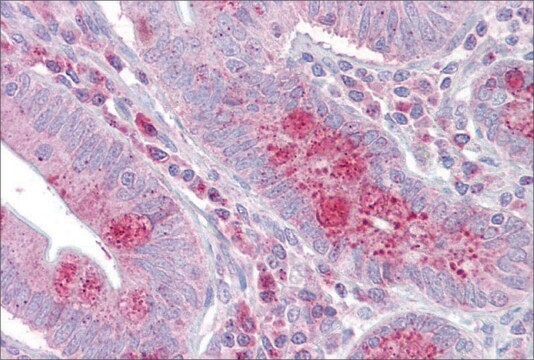 Anti-OAS1 (ab3) antibody produced in rabbit affinity isolated antibody