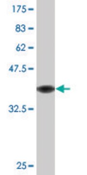 Monoclonal Anti-SORD, (N-terminal) antibody produced in mouse clone 2B8, purified immunoglobulin, buffered aqueous solution