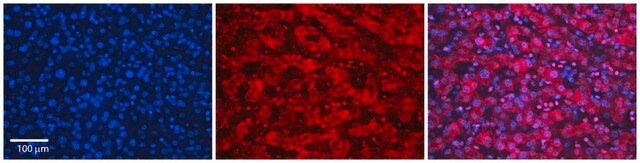 Anti-SLC26A3 antibody produced in rabbit affinity isolated antibody