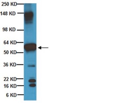 Anti-Beta III Tubulin Antibody Chemicon&#174;, from chicken