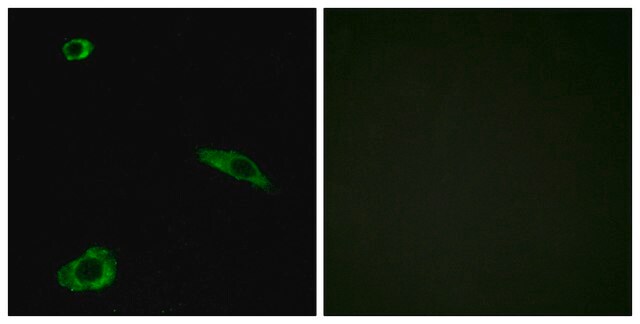 Anti-ACTHR antibody produced in rabbit affinity isolated antibody