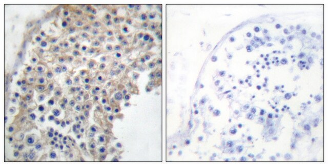 Anti-Adrenergic Receptor &#945;-2A antibody produced in rabbit affinity isolated antibody