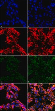 Monoclonal Anti-7-Ketocholesterol antibody produced in mouse clone 3F7